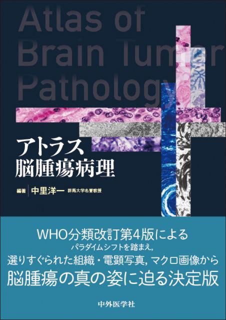 脳腫瘍臨床病理カラーアトラス - 健康/医学