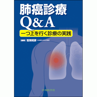 肺癌診療Q&A 一つ上を行く診療の実践