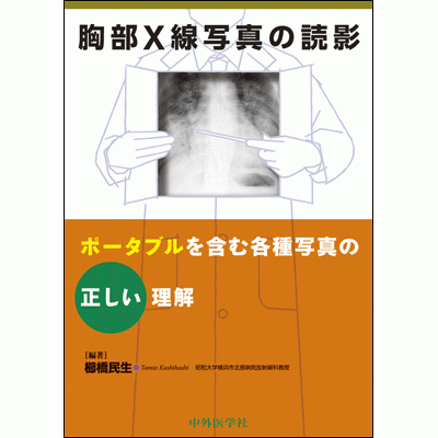 ポータブルを含む各種写真の正しい理解 胸部X線写真の読影