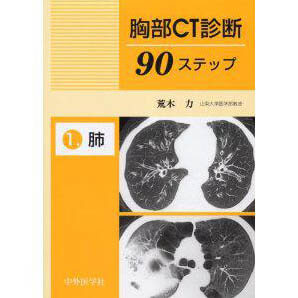 胸部CT診断90ステップ―1．肺