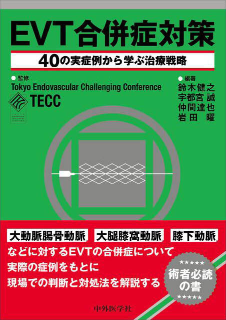 EVT合併症対策 ―40の実症例から学ぶ治療戦略