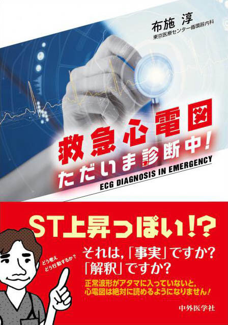 救急心電図　ただいま診断中！