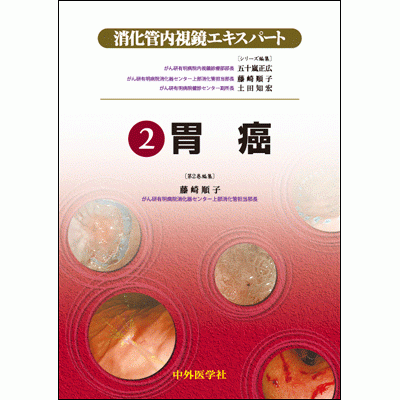消化器内視鏡エキスパート 2.胃癌