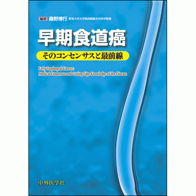 そのコンセンサスと最前線 早期食道癌
