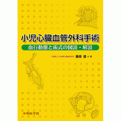 小児心臓血管外科手術 血行動態と術式の図説・解説