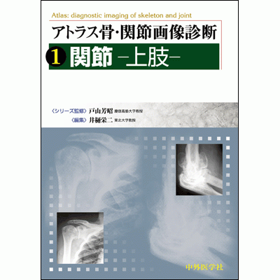 関節-上肢-