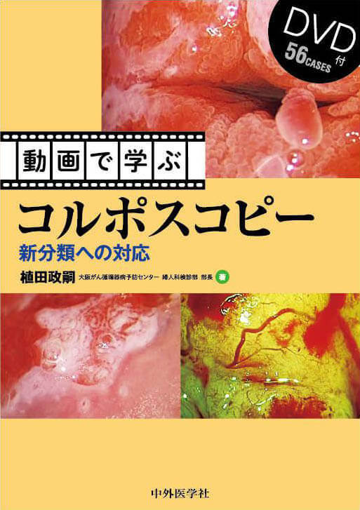 動画で学ぶコルポスコピー 新分類への対応