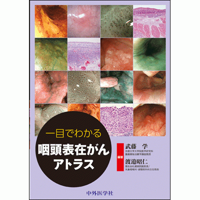 一目でわかる咽頭表在がんアトラス