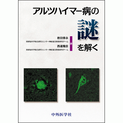 アルツハイマー病の謎を解く