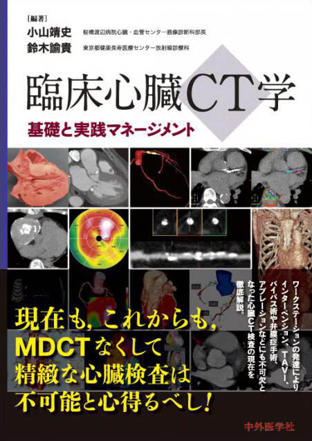 臨床心臓CT学−基礎と実践マネージメント