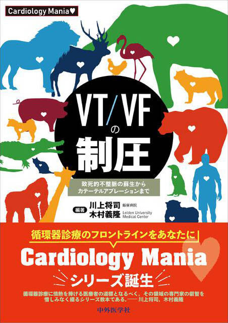 VT/VFの制圧 致死的不整脈の蘇生からカテーテルアブレーションまで
