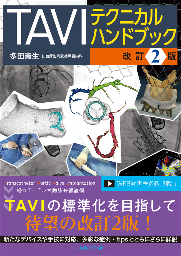 TAVIテクニカルハンドブック　改訂2版