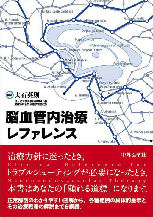 脳血管内治療レファレンス