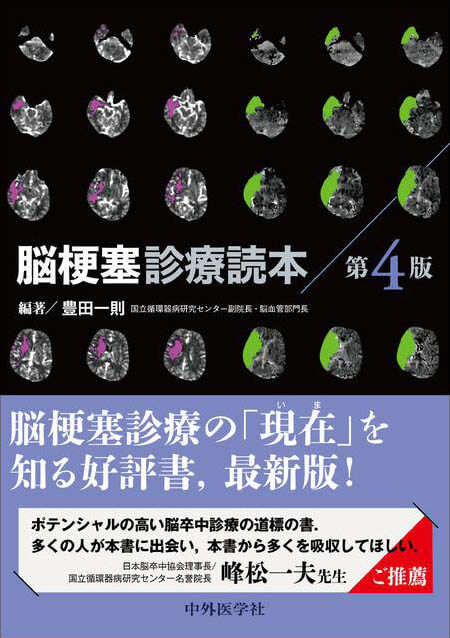 脳梗塞診療読本 第4版