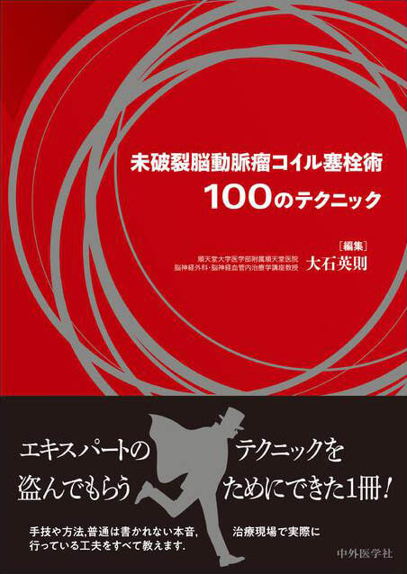 未破裂脳動脈瘤コイル塞栓術100のテクニック