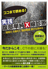 ココまで読める！実践腹部単純Ｘ線診断　 ―「透視力」を鍛えて「臨床推論能力」を高める―