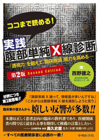 ココまで読める！実践腹部単純Ｘ線診断　2版 ―「透視力」を鍛えて「臨床推論能力」を高める―