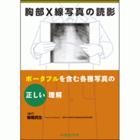 ポータブルを含む各種写真の正しい理解 胸部X線写真の読影