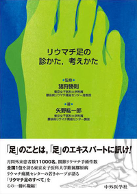 リウマチ足の診かた，考えかた