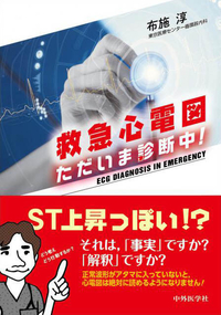救急心電図　ただいま診断中！