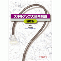 スキルアップ大腸内視鏡 治療編