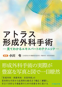 アトラス形成外科手術−見てわかるエキスパートのテクニック−