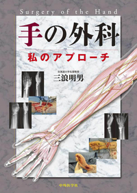 手の外科 -私のアプローチ