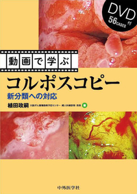 動画で学ぶコルポスコピー 新分類への対応