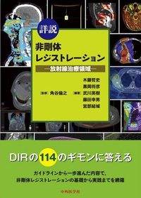 詳説 非剛体レジストレーション―放射線治療領域―