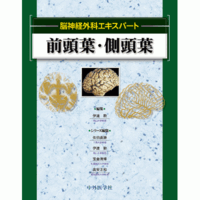 脳神経外科エキスパート 前頭葉・側頭葉