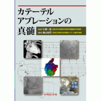 カテーテルアブレーションの真髄