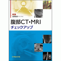 腹部CT・MRIチェックアップ