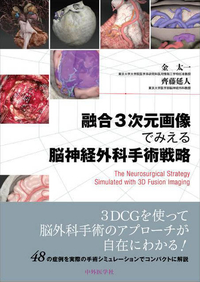 融合3次元画像でみえる脳神経外科手術戦略
