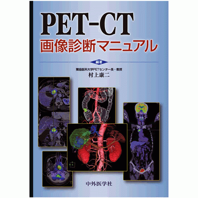 PET-CT画像診断マニュアル