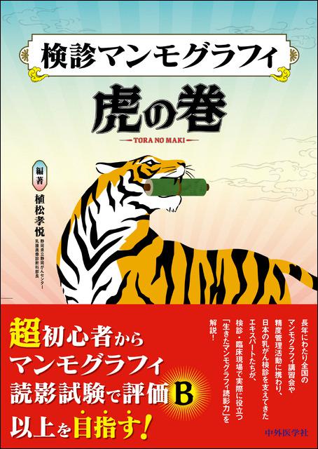 検診マンモグラフィ虎の巻