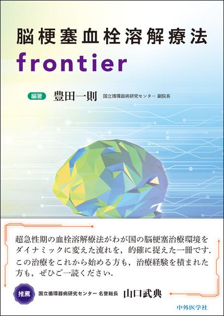 脳梗塞血栓溶解療法frontier
